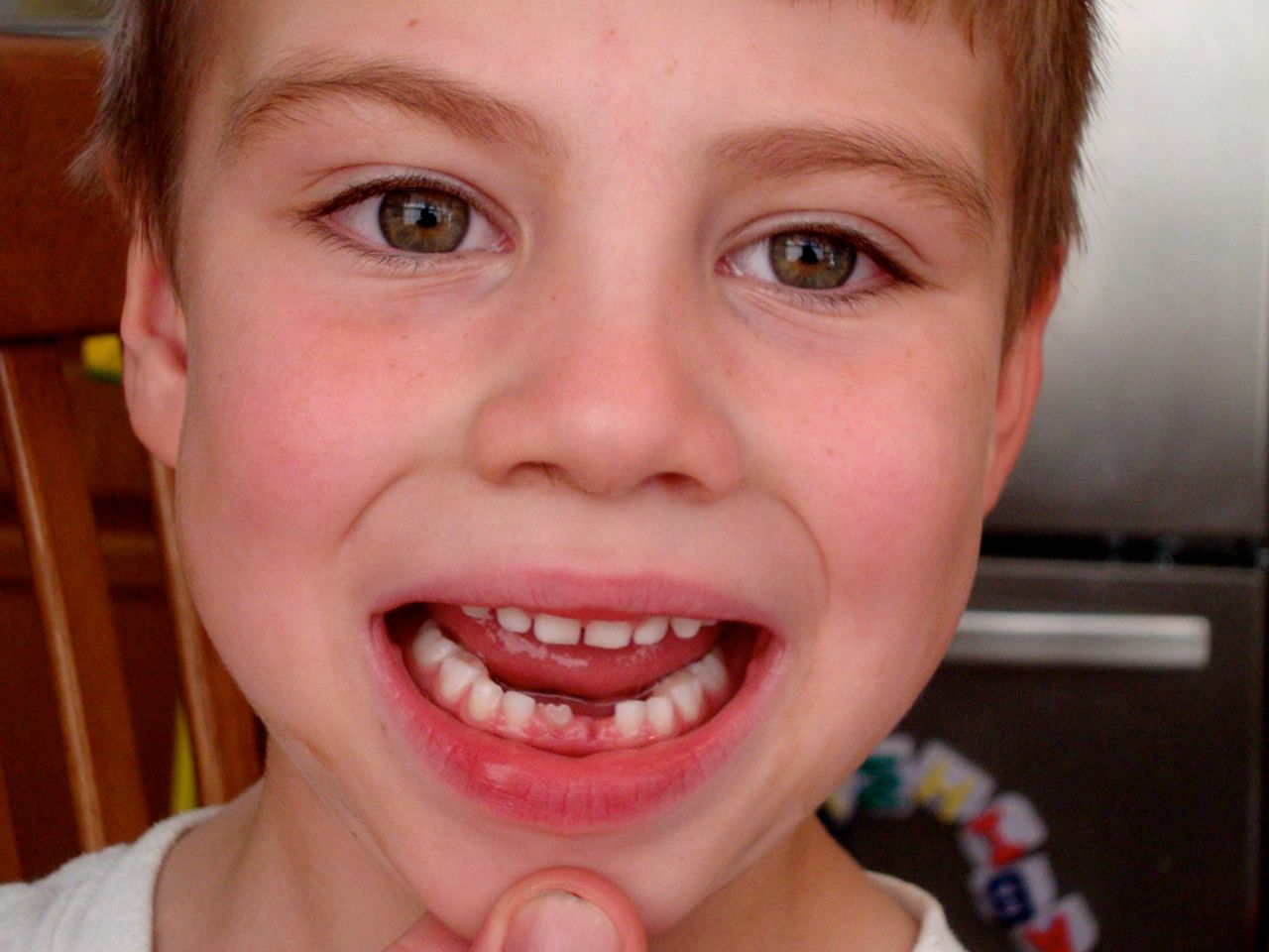  Boogie's first lost teeth! 