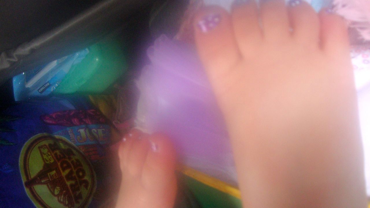Results from her first pedicure